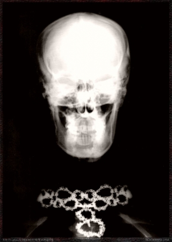 X-ray, 1979